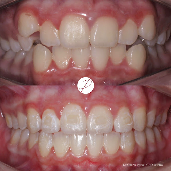 Foto 2 de Odontologia Estética - Dr. George Patta