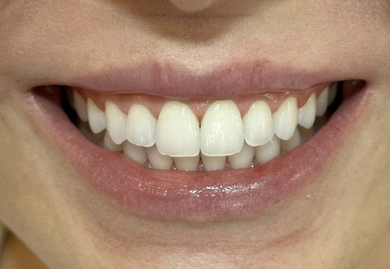 Foto 2 de Odontologia Estética e Preventiva - Dr Ana Karla Tebet Chalita de Mendonça