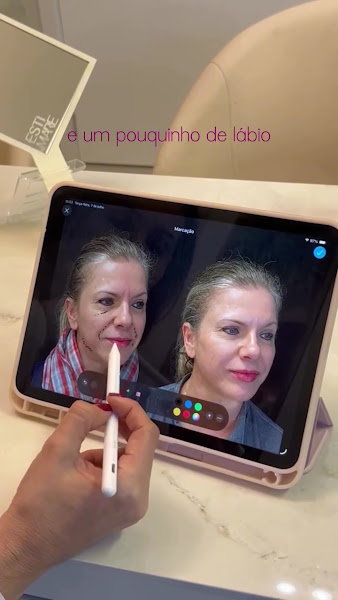 Foto 3 de ODONTOLOGIA & ESTÉTICA | Estimare Clinic