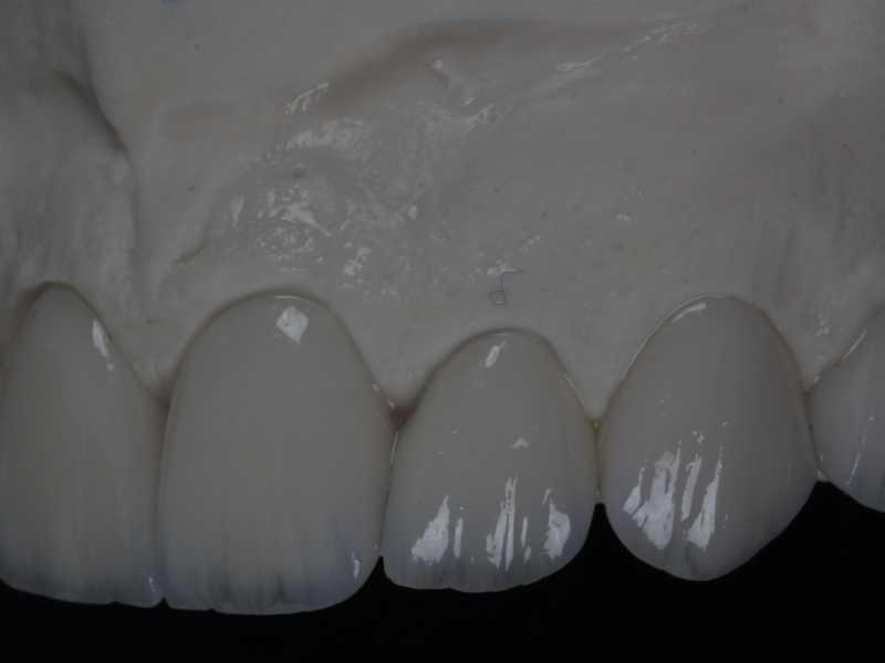 Foto 2 de Odontologia Estética & Funcional