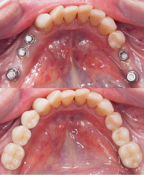 Foto 2 de Odontologia Estética Vila Velha- Dr. Rodrigo Cavalcanti