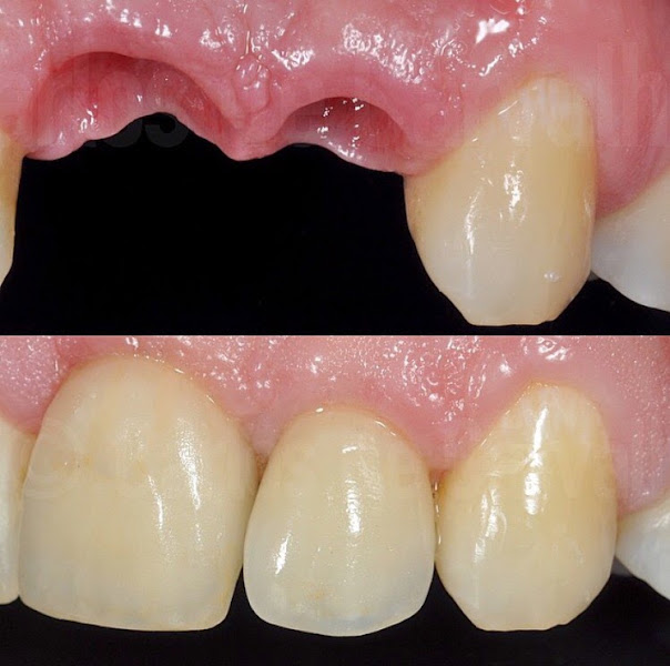 Foto 3 de Odontologia Estética Vila Velha- Dr. Rodrigo Cavalcanti