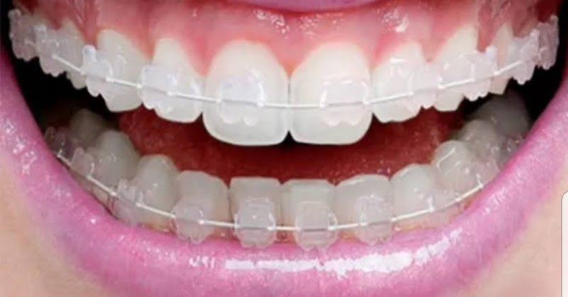 Foto 2 de Odontologia Floresta