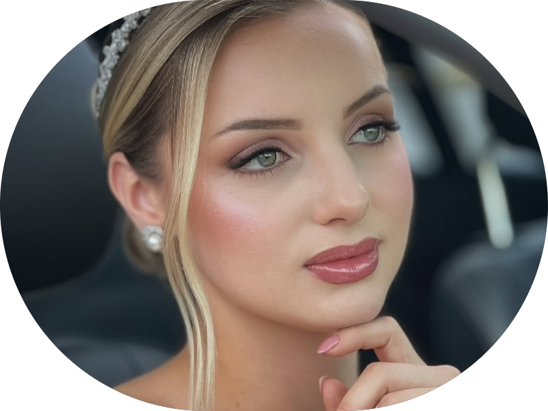 Foto 3 de Odontologia Fusinato - Facetas em Resina Guarapuava