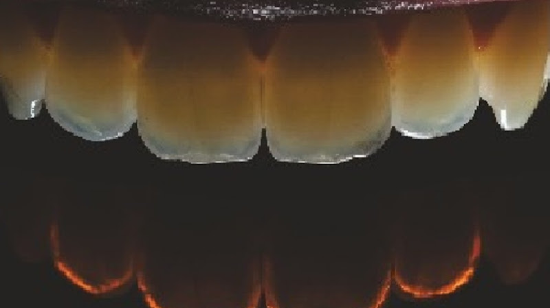 Foto 2 de Odontologia Gilson Nei Camargo