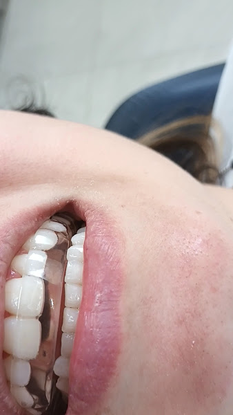 Foto 4 de Odontologia Giordano | Dentista em Sorocaba