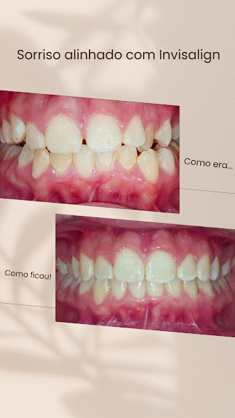 Foto 4 de Odontologia Giselle Amorim e Fábio Valladares