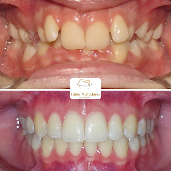 Foto 5 de Odontologia Giselle Amorim e Fábio Valladares