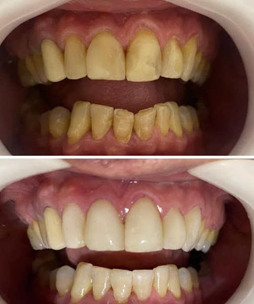 Foto 2 de Odontologia Goiânia II