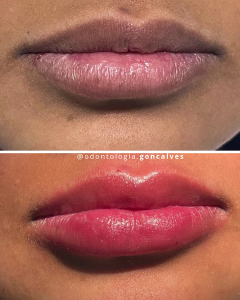 Foto 4 de Odontologia Gonçalves - Dra. Sandra Ribeiro Cirurgiã Dentista em Santo André