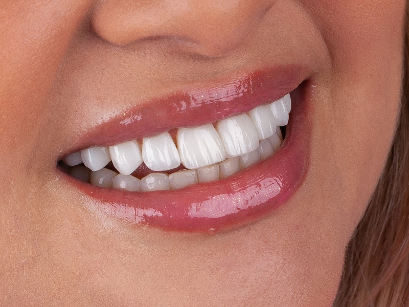 Foto 3 de Odontologia & Harmonia