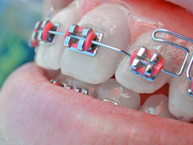 Foto 3 de ODONTOLOGIA HORIBE - Dr Edson Horibe Tanaka - Jd São João