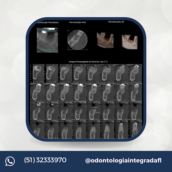 Foto 2 de Odontologia Integrada FL/ Bairro Menino Deus