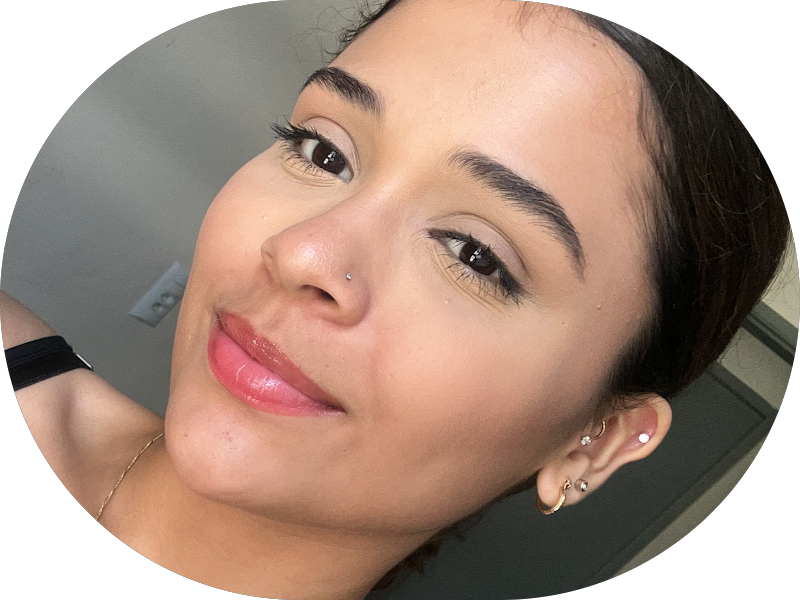 Foto 6 de Odontologia Integrada Recife | Implantes sem corte, sem dor e resultado imediato | Dentista em Recife/PE