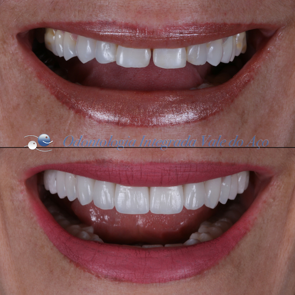 Foto 3 de Odontologia Integrada Vale do Aço