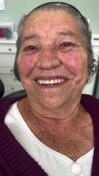 Foto 5 de Odontologia Jardim | Implantes dentários | Prótese Protocolo |Dentista em Jardim Santo André
