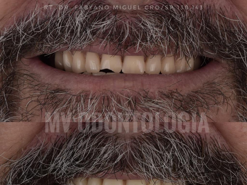 Foto 3 de Odontologia JV - Dra. Jeice Vieira | Dentista em Itu | Implantes em Itu | Aparelho em Itu
