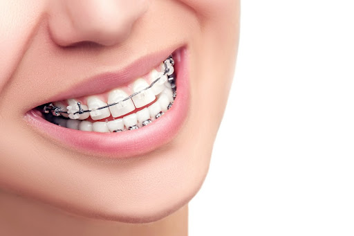 Foto 2 de ODONTOLOGIA LINHARES - RENATA PARK