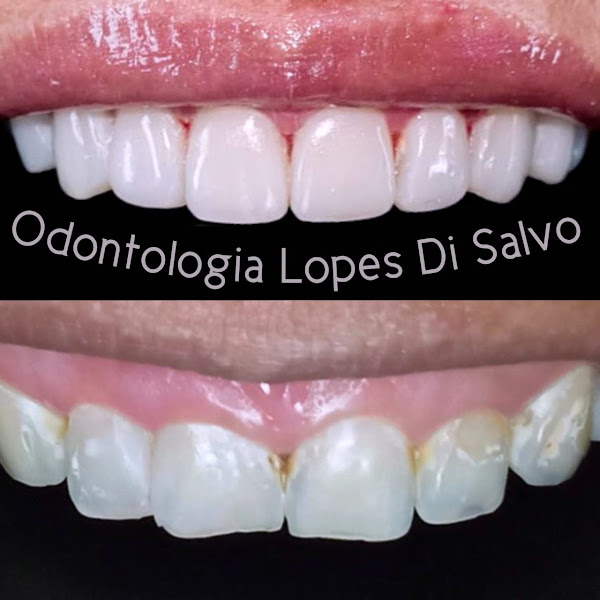 Foto 3 de ODONTOLOGIA LOPES DI SALVO