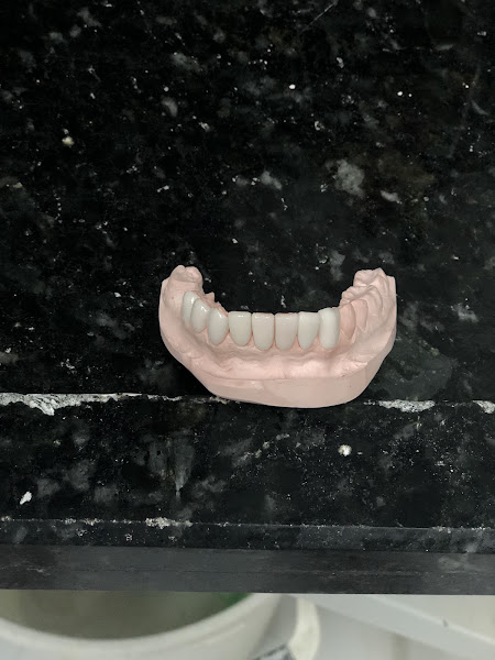 Foto 2 de Odontologia Mafrass - Dra Francieli A. de Souza Platner