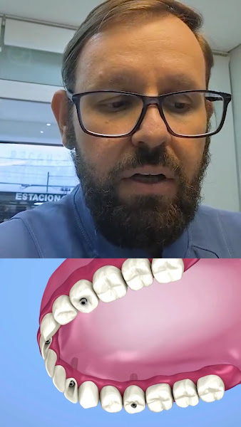 Foto 4 de Odontologia Moderna Penha | Implantes dentários | Dentista | Prótese | Penha São Paulo CroCl 027605