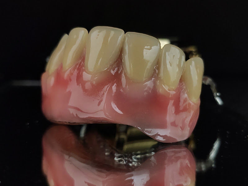 Foto 10 de Odontologia Moderna Penha | Implantes dentários | Dentista | Prótese | Penha São Paulo CroCl 027605