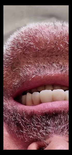 Foto 4 de Odontologia Nogueira - Dr Jonas Nogueira