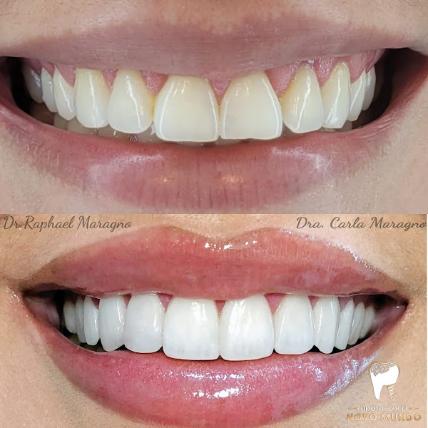 Foto 2 de Odontologia Novo Mundo - Implantes e Clínica Geral