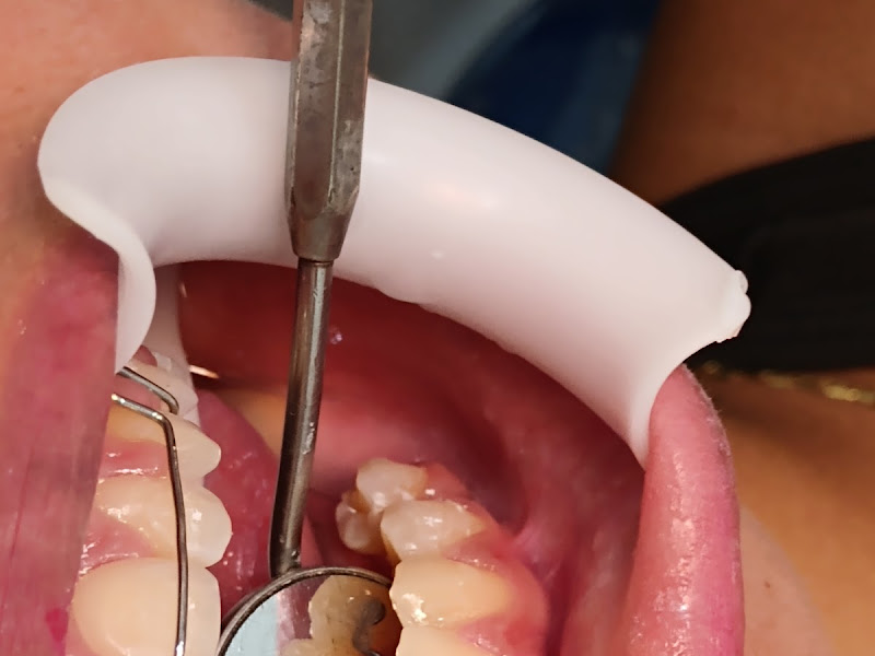 Foto 5 de Odontologia Personalizada Dra. Adriana Malheiros & Dr Rudys de Jesus