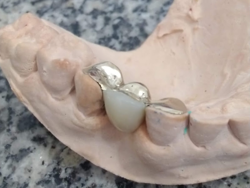 Foto 3 de Odontologia Pierre em Queimados RJ