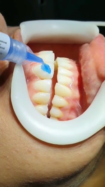 Foto 4 de Odontologia Pro-Riso Dra. Priscilla Braga