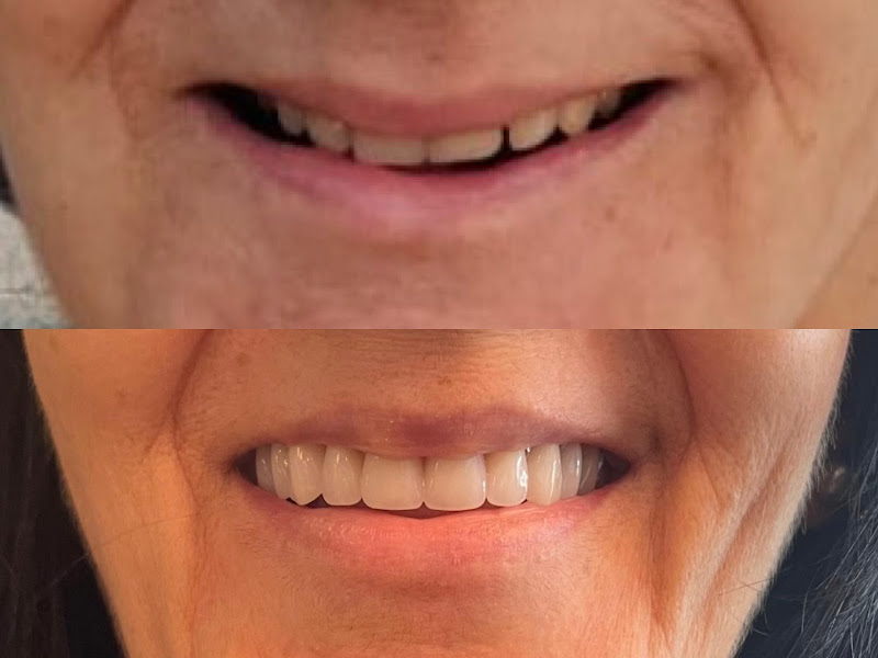 Foto 3 de Odontologia Reabilitação Oral e Estética - Dra(s) Elisângela Magalhães & Elaine Assis.