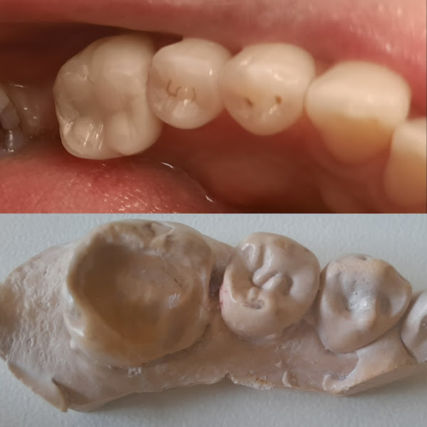 Foto 3 de odontologia Sílvia Gabriela dos Santos Gomes