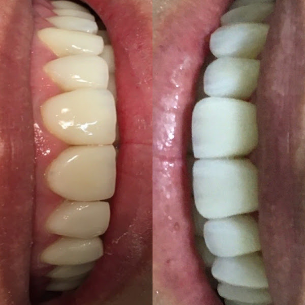 Foto 3 de Odontologia Sorriso Goiano