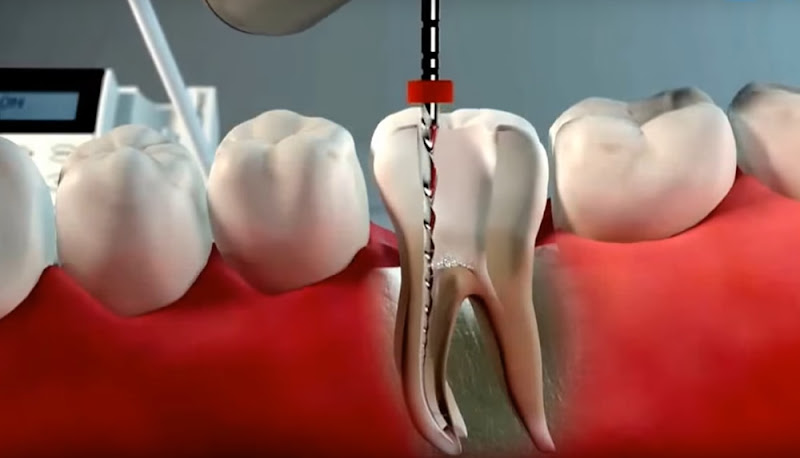 Foto 2 de Odontologia TORRES