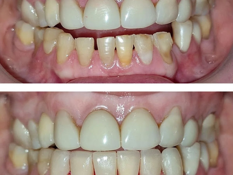 Foto 2 de Odontologia Valdir Brait - Dentista em Goiânia