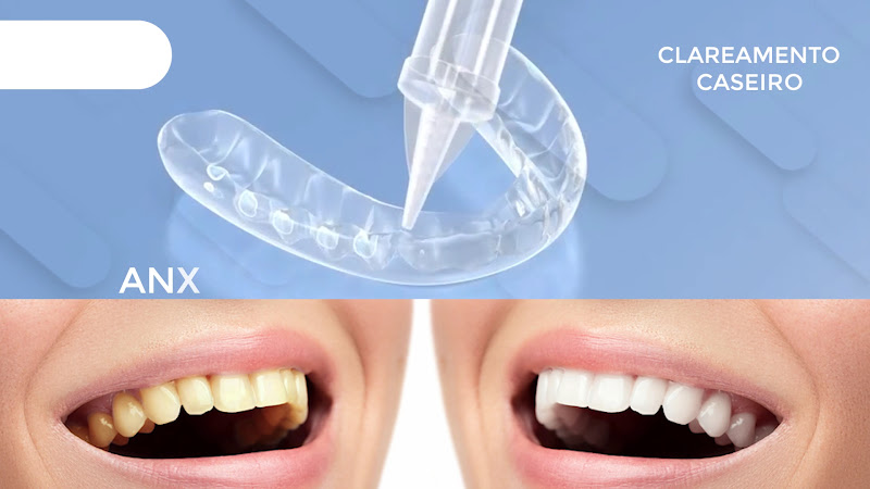 Foto 2 de Odontologia Vitta Oral - Lauro de Freitas