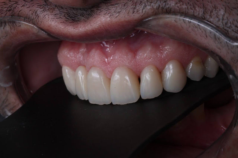 Foto 2 de ODONTOLOGIC - Laboratório de Próteses Dentária