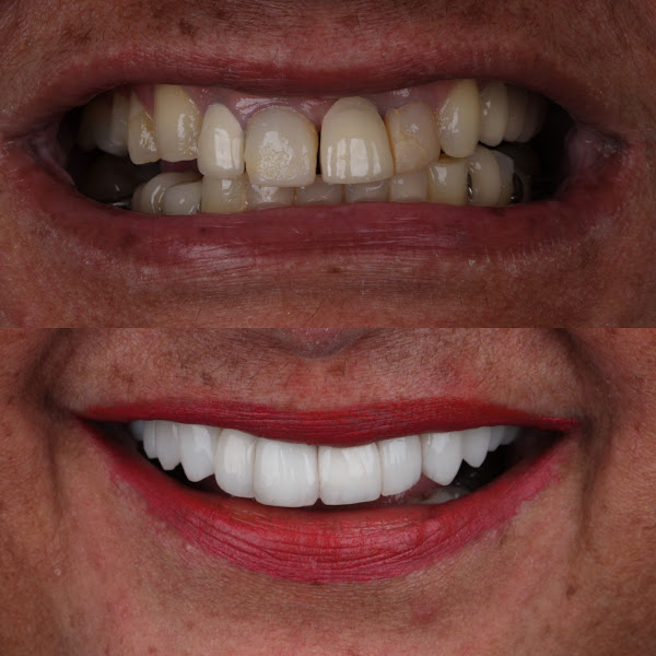Foto 2 de Odontolongia, Periodontia e Harmonização Facial - Dra Luciane Delilo
