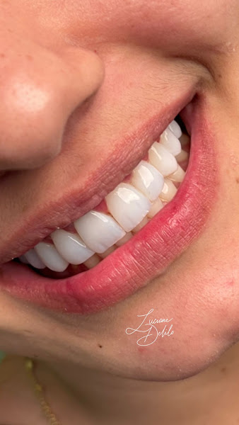 Foto 3 de Odontolongia, Periodontia e Harmonização Facial - Dra Luciane Delilo