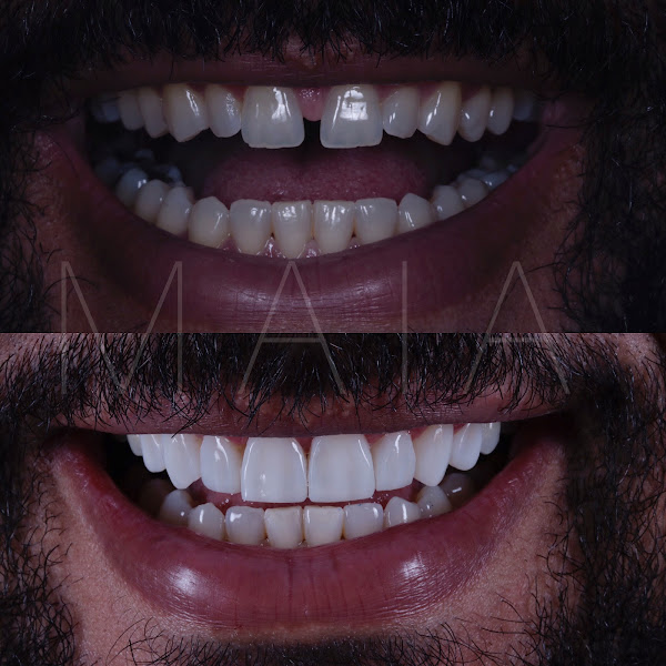 Foto 3 de OdontoMaia