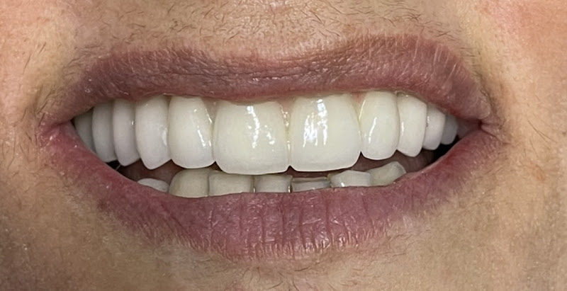 Foto 2 de OdontoMais Clínica Integrada -Dr João Victor Melo