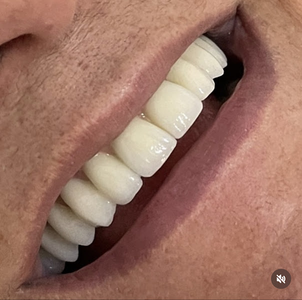 Foto 3 de OdontoMais Clínica Integrada -Dr João Victor Melo