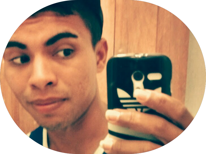 Foto 4 de OdontoMaster - Implantes Dentários, Facetas em resina