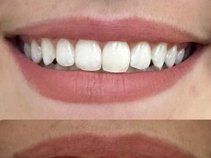 Foto de Odontomasther