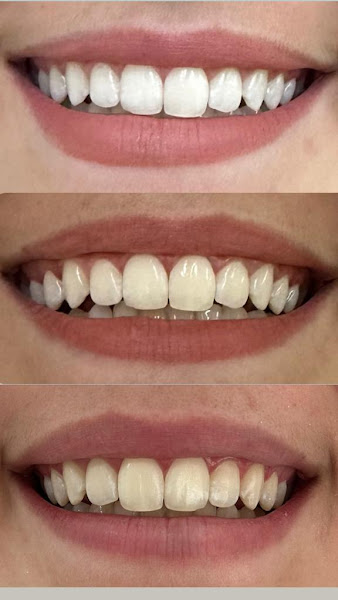 Foto 2 de Odontomasther