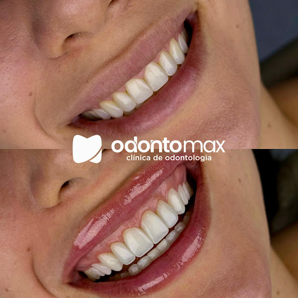 Foto 3 de Odontomax Cohatrac | Clínica Odontológica