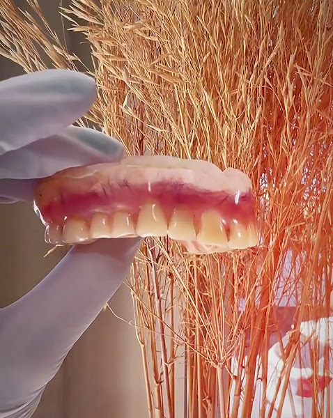 Foto 3 de ODONTOMAX - Nathália Duarte (CRO-40548) - Implante, Aparelho, Clareamento, Prótese