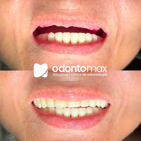 Foto 3 de Odontomax Ribamar | Clínica Odontológica