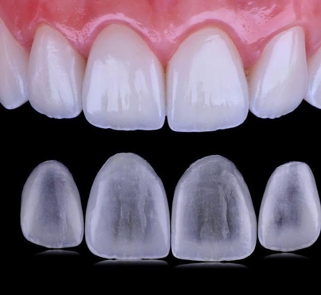 Foto 2 de OdontoMazali
